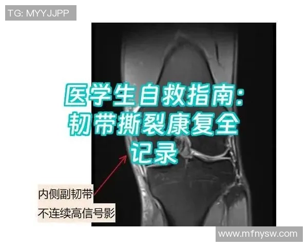 打篮球时不慎扭伤膝盖如何科学处理与康复指南 打篮球时不慎扭伤膝盖如何科学处理与康复指南